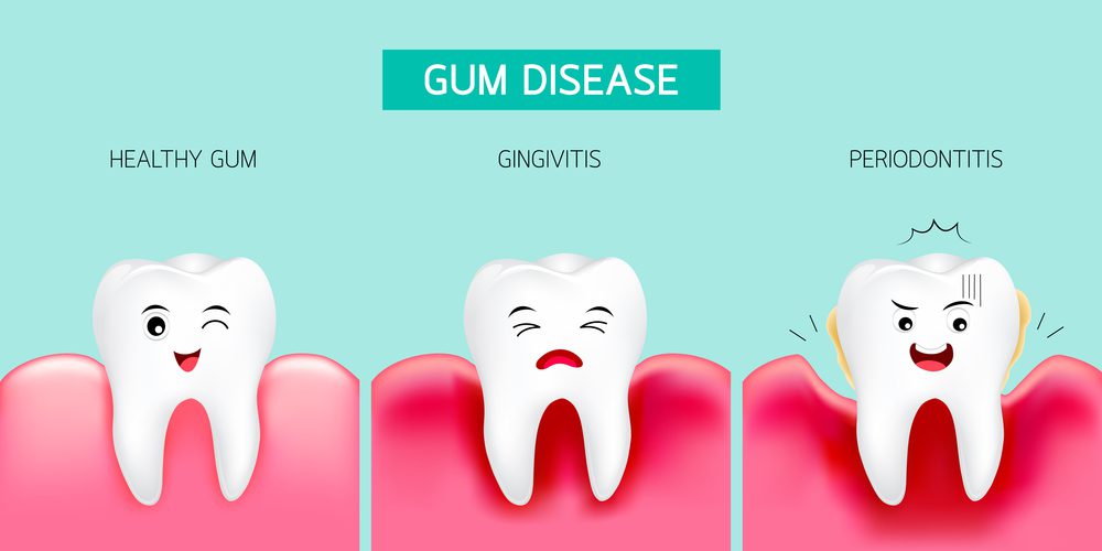 Gum Infections Unveiled: Causes, Symptoms, and Solutions