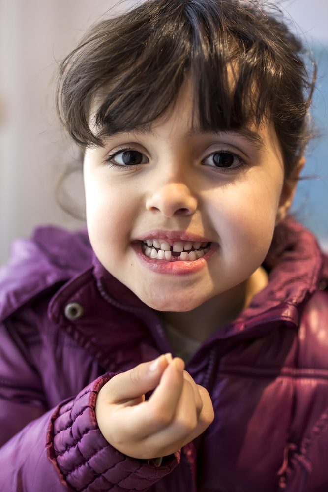 Little girl experiencing early baby tooth loss with a fallen baby tooth in his hand