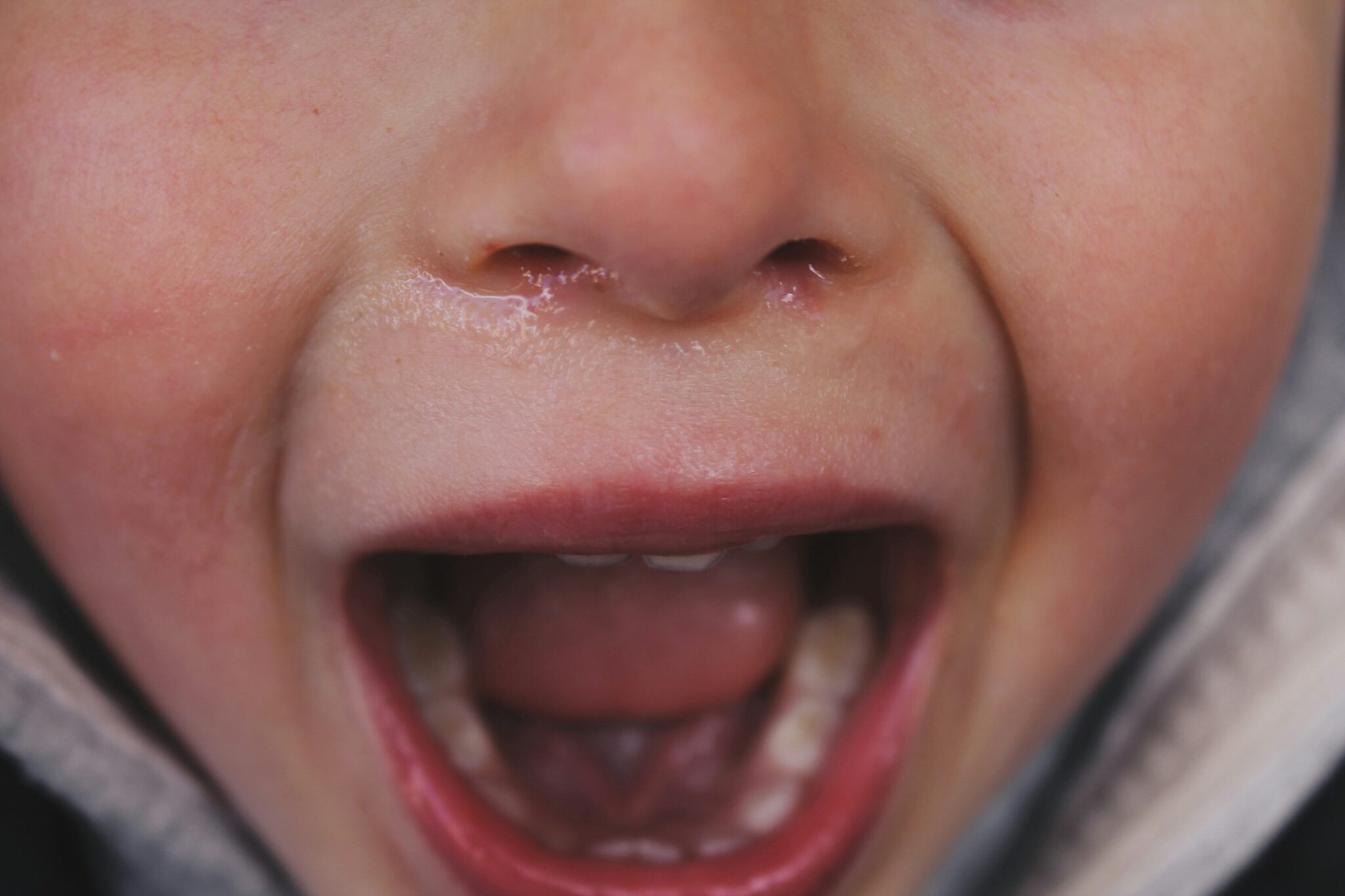 Close-up on crying child’s nose and mouth